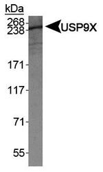 NBP1-48321 - USP9X