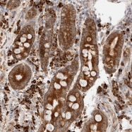 NBP1-80652 - Urotensin-2B (UTS2B / UTS2D)