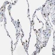 NBP1-86861 - UVRAG