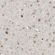 NBP1-83582 - UXS1 / UGD