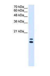 NBP1-55187 - UXT / HSPC024