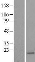 NBL1-17513 - Ube2B Lysate