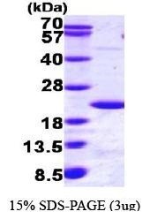 NBP1-44455 - UBE2B / RAD6B
