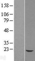 NBL1-17528 - Ube2G1 Lysate