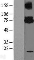 NBL1-17529 - Ube2G2 Lysate
