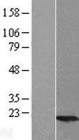 NBL1-17530 - Ube2G2 Lysate
