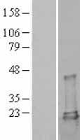 NBL1-17537 - Ube2L3 Lysate