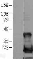 NBL1-17538 - Ube2L6 Lysate
