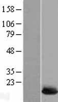 NBL1-17539 - Ube2L6 Lysate