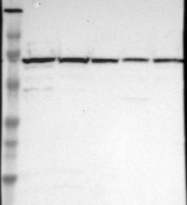 NBP1-85639 - Ubiquilin-2 (UBQLN2)