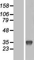 NBL1-17625 - Uridine Phosphorylase 1 Lysate