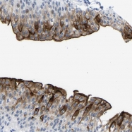 NBP1-86873 - Uroplakin-3a (UPK3A)