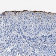 NBP1-86874 - Uroplakin-3a (UPK3A)