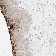 NBP1-92564 - Uroplakin-3b (UPK3B)