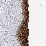 NBP1-80656 - Uroplakin-1b (UPK1B)