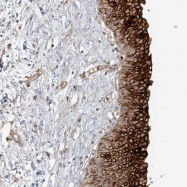 NBP1-80657 - Uroplakin-1b (UPK1B)