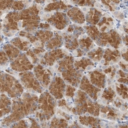 NBP1-84013 - VAMP-8 / Endobrevin