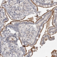 NBP1-86990 - Vang-like protein 1 (VANGL1)