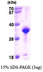 NBP1-37090 - VAMP-associated protein A (VAPA)