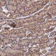 NBP1-82944 - Vasohibin-1 / VASH1