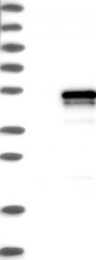 NBP1-82944 - Vasohibin-1 / VASH1