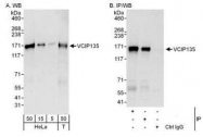 NBP1-49939 - VCPIP1