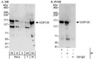 NBP1-49940 - VCPIP1