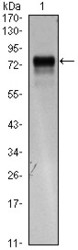 NBP1-51618 - VEGFR-3 / Flt-4