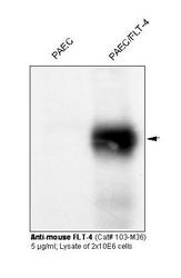 NBP1-18653 - VEGFR-3 / Flt-4