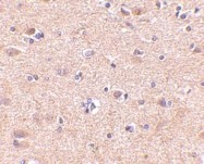 NBP1-76906 - VGF