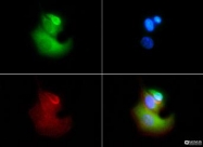 NBP1-78162 - VLDL-R / VLDL receptor