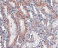 NBP1-78162 - VLDL-R / VLDL receptor