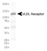 NBP1-78162 - VLDL-R / VLDL receptor