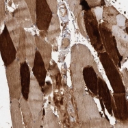 NBP1-86869 - Vomeronasal type-1 receptor 4 (VN1R4)