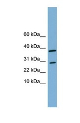NBP1-59753 - Vanin-3