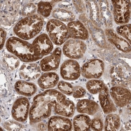 NBP1-81994 - VPS37A