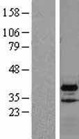 NBL1-17749 - VPS37B Lysate