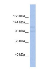 NBP1-56818 - VPS54