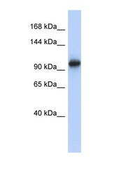 NBP1-57579 - VPS54