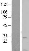 NBL1-17769 - VTI1B Lysate