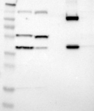 NBP1-85336 - Villin-1