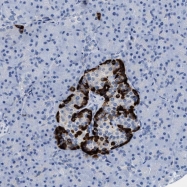 NBP1-88027 - Vitamin D-binding protein