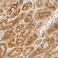 NBP1-88028 - Vitamin D-binding protein