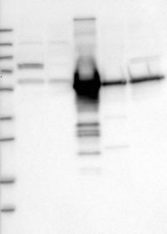 NBP1-88027 - Vitamin D-binding protein