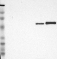 NBP1-88028 - Vitamin D-binding protein