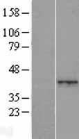 NBL1-17774 - WARS2 Lysate
