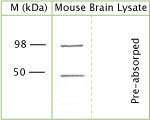 NB110-74960 - TRPV4 / Vanilloid receptor-like protein 2
