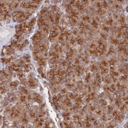 NBP1-80988 - WBP11