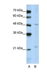 NBP1-53111 - WDR12