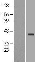 NBL1-17800 - WDR31 Lysate